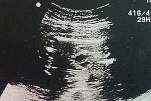妊娠24週エコー写真